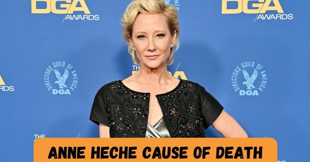 Anne Heche Cause Of Death