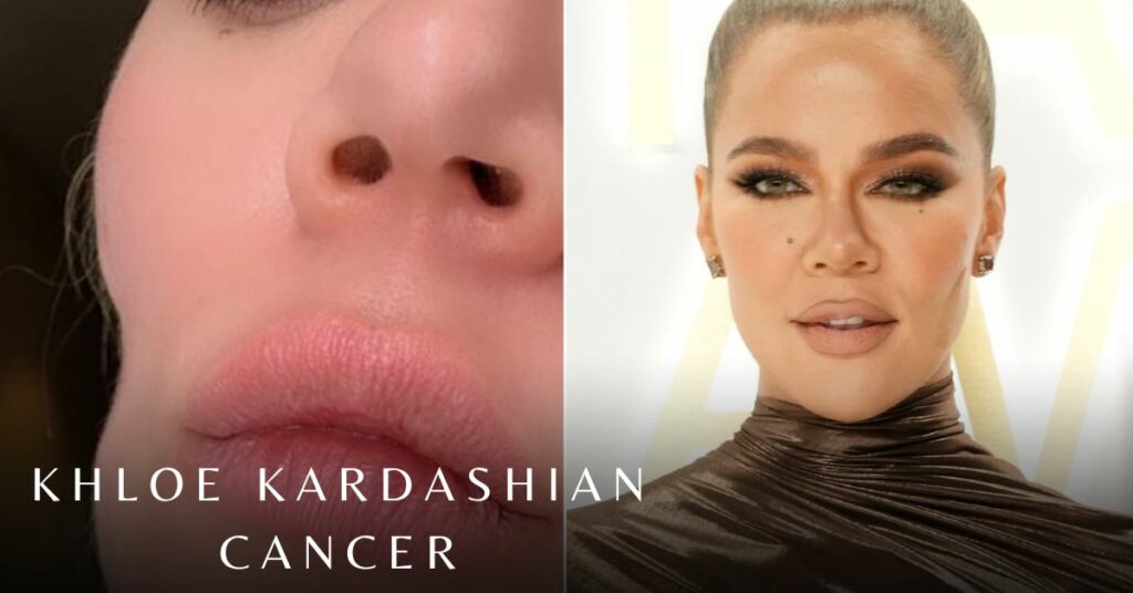 Khloe Kardashian Cancer