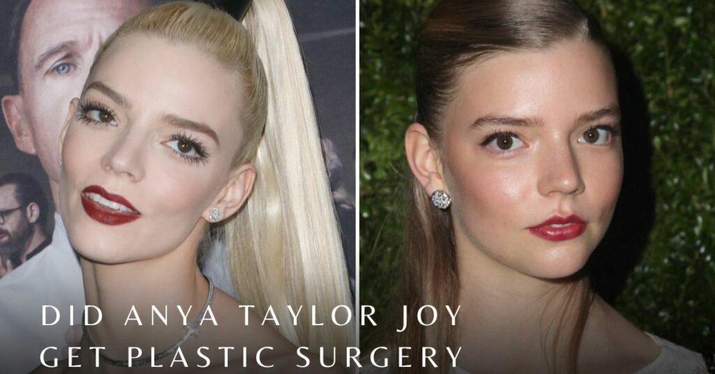 Did Anya Taylor Joy Get Plastic Surgery