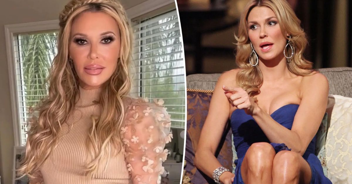 Did Brandi Glanville Have Plastic Surgery?