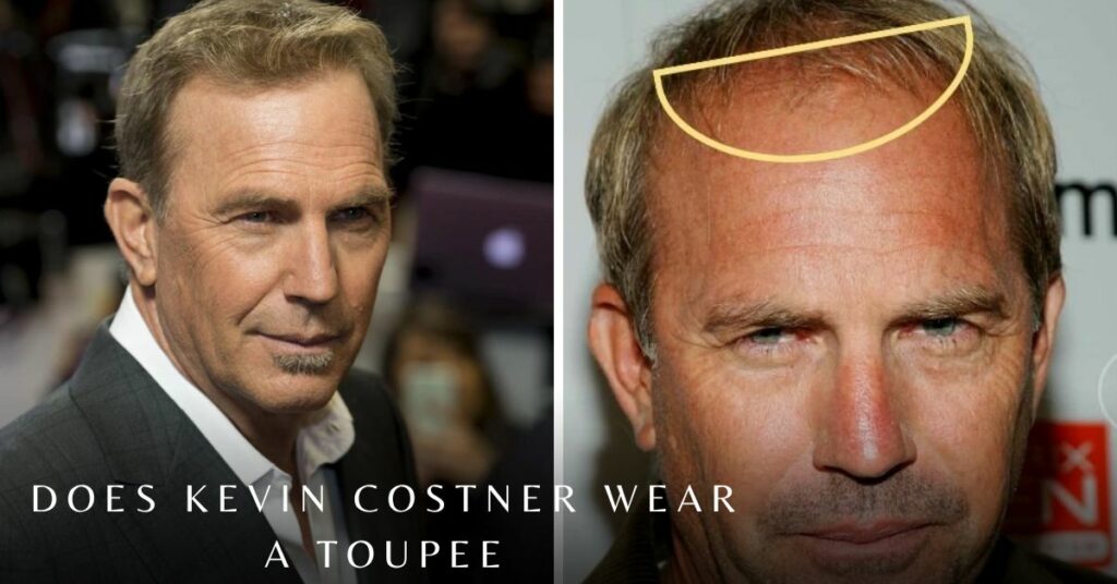 Does Kevin Costner Wear a Toupee