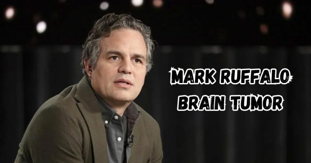 Mark Ruffalo Brain Tumor